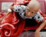 Yemen-malati-di-cancro